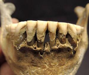 　ウクライナから出土した中世人骨の歯石（オレクサンドラ・コザク博士提供）