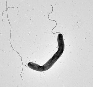 　コレラ菌の電子顕微鏡写真（許駿琉球大助教提供）