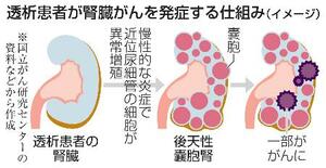 　透析患者が腎臓がんを発症する仕組み（イメージ）