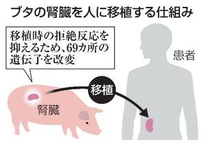 　ブタの腎臓を人に移植する仕組み