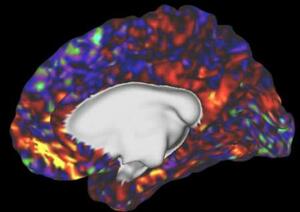 脳機能を捉える「機能的磁気共鳴画像装置(fMRI)」で撮影した画像(国際電気通信基礎技術研究所提供)