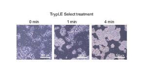 　酵素処理により細胞間の結合が弱まる様子（左から右へ）を示すｉＰＳ細胞の顕微鏡画像（（Ｃ）２０２５　Ｅｌｓｅｖｉｅｒ　Ｂ．Ｖ．　Ａｌｌ　ｒｉｇｈｔｓ　ａｒｅ　ｒｅｓｅｒｖｅｄ，　ｉｎｃｌｕｄｉｎｇ　ｔｈｏｓｅ　ｆｏｒ　ｔｅｘｔ　ａｎｄ　ｄａｔａ　ｍｉｎｉｎｇ，　ＡＩ　ｔｒａｉｎｉｎｇ，　ａｎｄ　ｓｉｍｉｌａｒ　ｔｅｃｈｎｏｌｏｇｉｅｓ．）