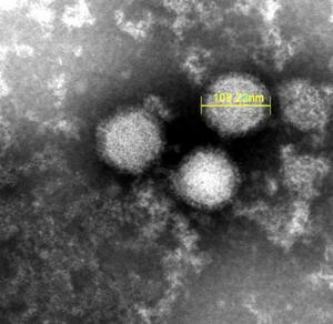 「重症熱性血小板減少症候群」を引き起こすウイルスの電子顕微鏡写真(国立健康危機管理研究機構提供)