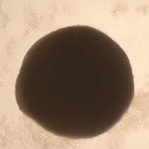 iPS細胞からつくったネフロン癆の病態を再現したミニ腎臓(東京科学大提供)
