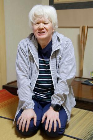 アルビノの当事者や家族と交流してきた石井更幸さん=千葉県袖ケ浦市