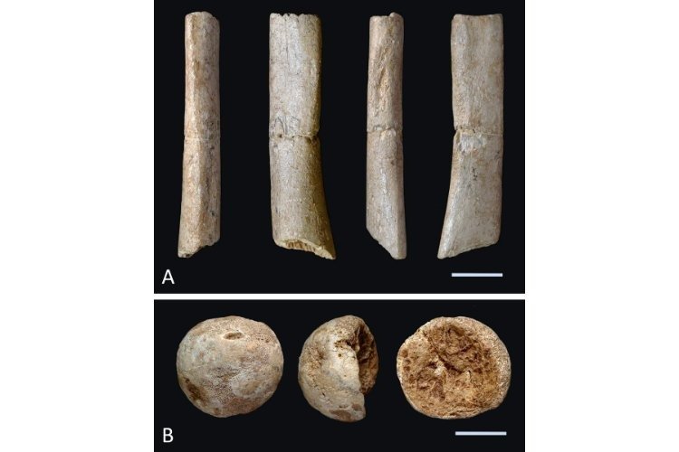 img_78178bbf5ec0838bd124d24820