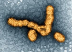 インフルエンザウイルスの電子顕微鏡写真(米国立アレルギー感染症研究所提供)