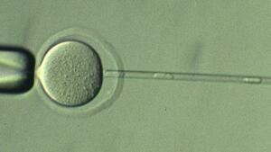 　核を取り除いた卵子に体細胞から取り出した核を移植する様子（山梨大提供）