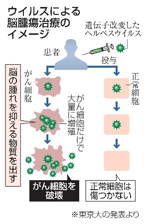 　ウイルスによる脳腫瘍治療のイメージ