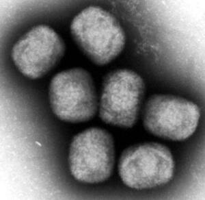 　エムポックスウイルスの電子顕微鏡写真（国立感染症研究所提供）