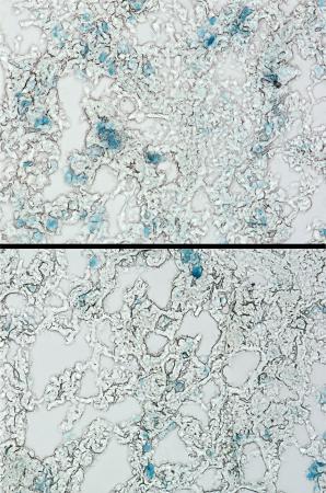 　未治療の肺線維症のマウスで老化細胞（青色）が存在する様子（上）と、ナトリン３ｂを投与し老化細胞（青色）が減少した様子（京都大近藤祥司准教授提供）