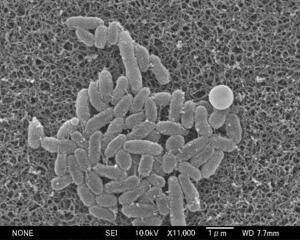 百日ぜき菌の電子顕微鏡画像(国立健康危機管理研究機構提供)
