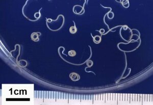 アニサキスの幼虫（国立感染症研究所提供、同研究所のホームページに掲載された画像をトリミングしています）