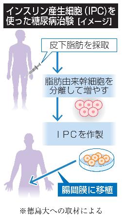 インスリン産生細胞(IPC)を使った糖尿病治験(イメージ)