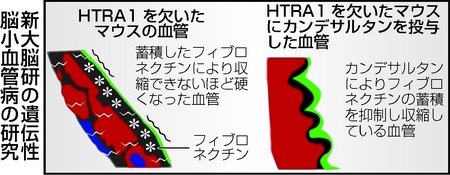 脳動脈硬化抑制に既存降圧薬が有効 新潟日報デジタルプラス