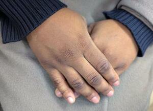 　取材に応じるナイジェリア出身のエマさん（仮名）＝１月２３日