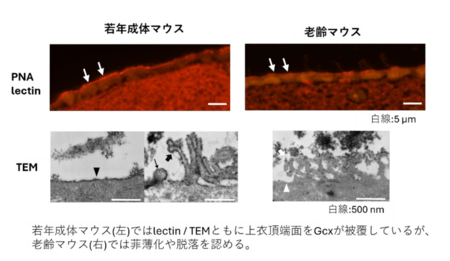 脳室を守る“糖のバリア”が老化や出血で壊れる仕組みを解明 国立大学