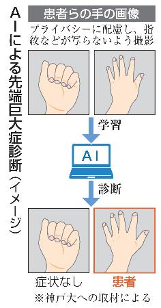 AIによる先端巨大症診断(イメージ)